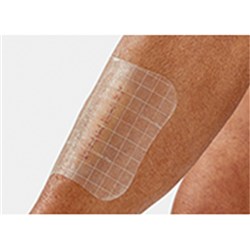 Comfeel Plus Transparent Dressing 10 x 10cm B10