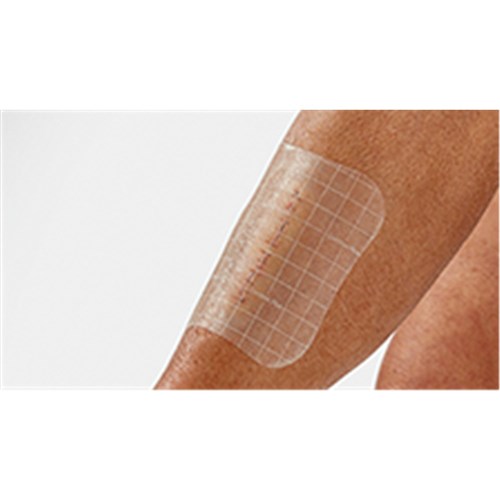 Comfeel Plus Transparent Dressing 5 x 7cm B10