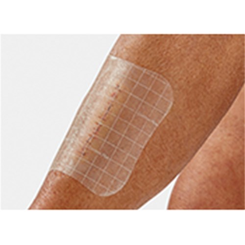 Comfeel Plus Transparent Dressing 10 x 10cm B10