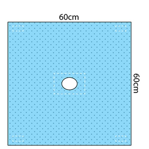 Multigate Fene Adhes Procedure Drape Sterile 60 x 60cm