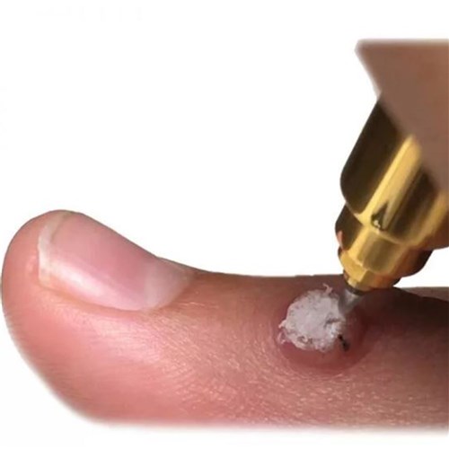 CryoIQ Derm Plus with 1mm Tip & N20 16g Cartridge