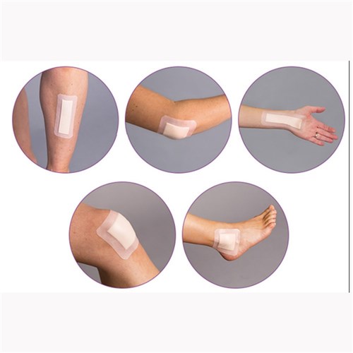 FoamLite Adhesive Dressing 5cm x 5cm