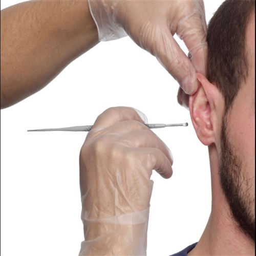 ProPulse ProScoop Single Use Ear Wax Removal Scoop  P40